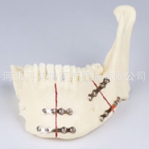 Modelo de Mandíbula Dt M5001, Instrumento Quirúrgico Dental para Entrenamiento en la Cavidad Oral - Product Image 1