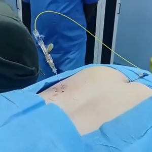Pldd percutaneous Laser đĩa giải nén Diode máy laser 980nm + 1470nm cột sống giải nén Máy trị liệu - Product Image 1