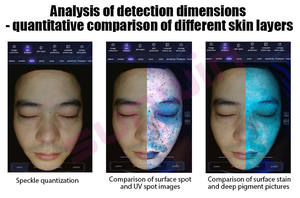 2024 휴대용 3D AI 얼굴 피부 분석기 시스템 얼굴 테스터 스캐너 마술 얼굴 거울 장치 피부 분석 기계 피부 분석기 - Product Image 6