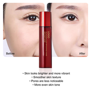 โทนเนอร์ OEM กรดไกลโคลิก ไวท์เทนนิ่ง ทำความสะอาดล้ำลึก ควบคุมความมัน ลดสิว ผสมไฮยาลูรอนิค แอซิด ผลัดเซลล์ผิว 150 มล. สำหรับทุกสภาพผิว - Product Image 5