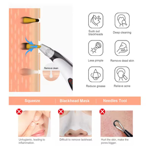 Electric Face Deep Cleaner <b>Blackhead</b> Pore Shrinking <b>Blackhead</b> <b>Remover</b> <b>Vacuum</b> Pore Cleaner - Product Image 5