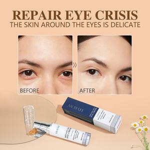 Contrassegno privato Anti gonfiore ridurre le occhiaie rughe liscia rimozione istantanea della borsa per gli occhi sotto crema - Product Image 4