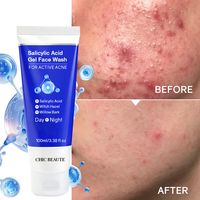 CHIC BEAUTE Limpiador Facial con Ácido Salicílico al 1% para Eliminar y Reparar el Acné, 100 ml, Tratamiento para el Acné, Limpiador Facial