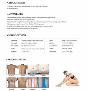 Venta caliente Equipo Máquina de belleza láser de diodo para barra apilable para tratamientos de spa para el cabello - Product Image 6