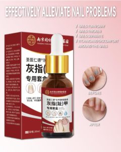 Kit de cepillos para hongos <span class=keywords><strong>en</strong></span> <span class=keywords><strong>manos</strong></span> y pies con líquido herbal de 30 ml para el tratamiento de uñas de <span class=keywords><strong>manos</strong></span> o pies, con servicio OEM/ODM - Product Image 5