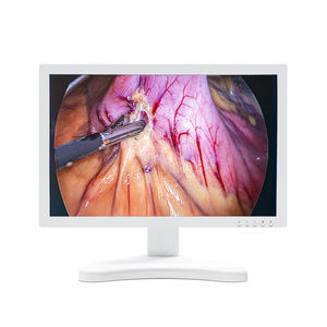 CHANGFAN Full HD video endoskop kamera sistemi laparoskopi ENT üroloji artroskop jinekoloji için 1080P - Product Image 6