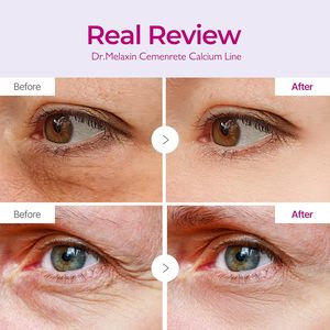 Patchs pour les yeux au calcium Cemenrete Volume 60ea, patchs pour les yeux au calcium repulpants, nourrissent la peau fragile sous les yeux, améliorent l'élasticité de la peau - Product Image 2