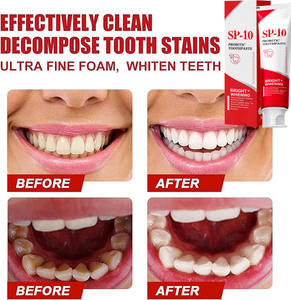 Pasta Dental Blanqueadora Probiótica SP-10 para Fumadores y Consumidores de Café, Elimina Manchas, Refresca el Aliento, Cuidado Dental con Sabor a Menta, 120g - Product Image 2