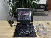 Échographe Doppler couleur portable pour hôpital, meilleur prix, ordinateur portable, appareil d'échographie humaine CU20