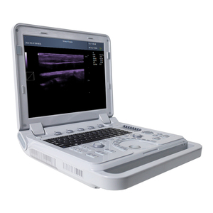 CONTEC CMS600P2 PLUS Tragbares Ultraschallgerät mit Farbdoppler, Medizinisches Ultraschallgerät mit Pulsspektraldoppler - Product Image 2