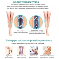 Chaussettes de compression médicale personnalisées grande taille respirantes antidérapantes à hauteur du genou 15-21/23-32/32-46mmHg à bout ouvert avec logo brodé pour usage quotidien