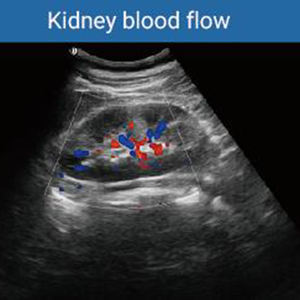 Alat diagnostik ultrasonik warna 3D/4D/5D, pemindai Ultrasound eksklusif portabel, peralatan Ultrasound - Product Image 3