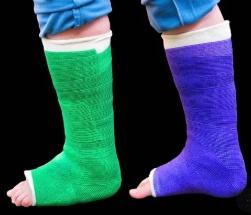 Senolo Les Bandages En Polymere Remplacent Les Bandages En Platre Pour Les Fractures De La Jambe De La Cheville Et De La <span class=keywords><strong>Main</strong></span> - Product Image 3