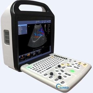 Escáner de Ultrasonido Doppler a Color Digital de Alta Resolución, Sistema de Imágenes Ultrasónicas para Embarazo, Veterinaria y Uso Humano CU23 - Product Image 1