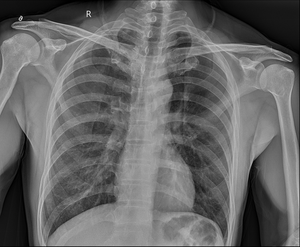 Sistema <span class=keywords><strong>CR</strong></span> a pannello DR a raggi x più economico, <span class=keywords><strong>CR</strong></span> portatile per macchina a raggi x MSLFP33 - Product Image 5