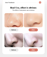 Aspirateur à bulles électrique à main Dermabrasion de l'eau Hydra Peeling Aqua Facial Clean Beauty Machine