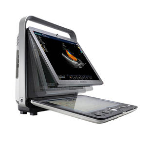 Système d'échographie vétérinaire diagnostique Sonoscape S9V Premium, réutilisable et durable, pour une pratique clinique exigeante - Product Image 5