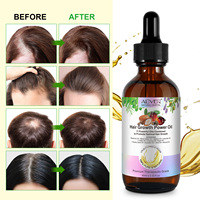 ALIVER 100% Perawatan Rambut Alami Murni 11 Minyak Ampuh Pertumbuhan Rambut Cepat Campuran Minyak Perawatan Kerontokan Rambut untuk Wanita dan Pria
