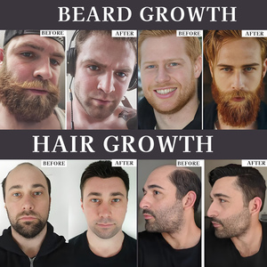 Gomitas para el crecimiento de la barba del cabello de los hombres con etiqueta personalizada, soporta la salud de la barba masculina y gruesa, vitaminas, gomitas formuladas para hombres - Product Image 3