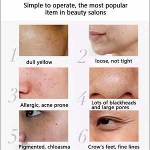 S Private Logo Éponge Microneedling Crème & Sérum Réparateur Éponge Spicules Crème Fade Acné <span class=keywords><strong>Cicatrice</strong></span> Tache Sombre Contrôle De L'huile Calme Rougeurs - Product Image 4