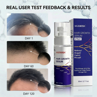 Sérum Capillaire Végétalien Repousse Cheveux Force Maximale à l'Acide Hyaluronique, Niacinamide, Redensyl, Capixyl, Procapil, Anagain – Marque Blanche OEM & Global