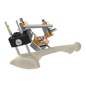 CANWELL Hoffman Externe Fixatie Instrumentenset Staaf Staaf 11mm Compact Systeem Orthopedisch Klasse III Levenslange Garantie Model Geschikt voor - Product Image 4