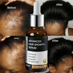 Sérum Capillaire Avancé Personnalisé de 30 ml pour la Croissance des Cheveux et du Cuir Chevelu, avec 3% Redensyl + 3% Procapil + 3% Anagain et des Ingrédients Biologiques - Product Image 3