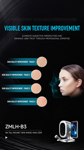 3D AI Intelligent Skin Analyzer & Color Detector for Face Commercial Use with Touch Screen and EU/US <b>Plug</b> Compatibility - Product Image 5