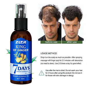 Green Ginger Anti-Hair Prevent Loss Oil,Ginger 7 Days Hair Growth Nourishing Regrowth <b>Spray</b>,King of Ginger Spraying - Product Image 5