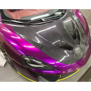 Mm570 S 570GT 600LT 2015-2020 için P1 stil kuru karbon Fiber kaput - Product Image 3