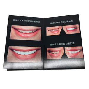 Materiales Dentales: Blanqueamiento Dental, Carillas de Porcelana, Catálogo de Carillas de Porcelana Total, Álbum de Fotos de Cristal, Exhibidor - Product Image 1