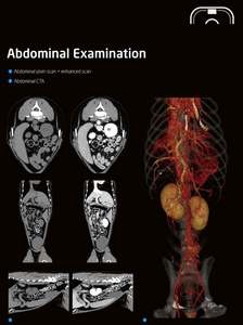 Sistema di tomografia del Computer veterinario diagnosi di malattia medica per animali domestici ospedale Computer tomografia Scanner Vet <span class=keywords><strong>CT</strong></span> - Product Image 5