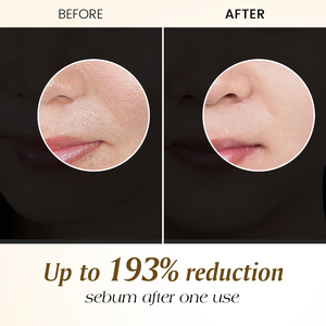 Ampoule exfoliante au riz blanc 60 ml en gros pour le contrôle du sébum et l'éclaircissement avec sérum visage au niacinamide et ferment <span class=keywords><strong>de</strong></span> riz - Product Image 4
