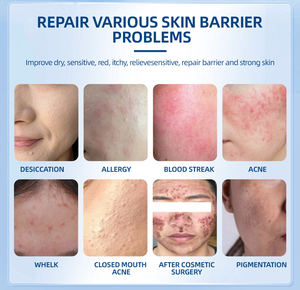 Crème de blanchiment complet de la peau efficace en gros crème de marque privée pour les allergies cutanées crème éclaircissante pour la peau - Product Image 3