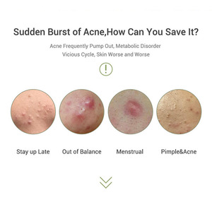 유기농 비건 심황 허브 페이스 크림 비타민 B5 안티 여드름 모공 수축 미백 크림 - Product Image 5