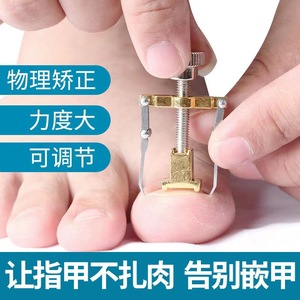 Custom Toenail Corrector Metal Adjustable Toe Nail Straightener For Ingrown Nail Correction Silver Gold Color Single Unit - Product Image 3