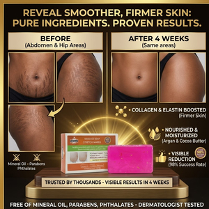 Savon pour le corps massant réduisant l'apparence des vergetures avec collagène, huile d'argan, élastine et beurre de cacao - Product Image 1
