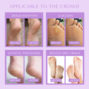 Chaussettes de spa exfoliantes pour les pieds au beurre de karité minéral blanchissant – Offre spéciale - Product Image 4