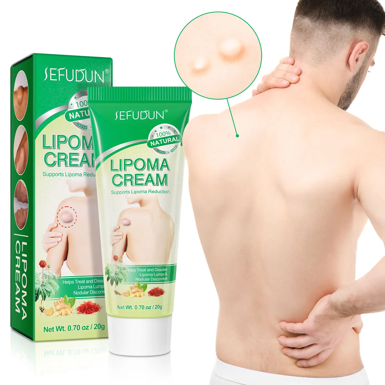 SEFUDUN Kem Điều Trị Lipoma Giảm Đau Hiệu Quả Thảo Dược Tự Nhiên, Kem Loại Bỏ Lipoma, Kem Lipoma