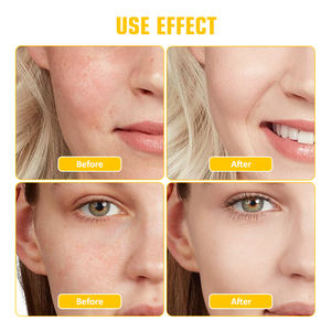 Serum Perawatan Kulit - Menghaluskan, Meratakan, Mengelupas Kulit dengan Lembut - untuk Garis-Garis Halus, Tekstur, Bintik Hitam - Meningkatkan Perputaran Sel Kulit - Product Image 4