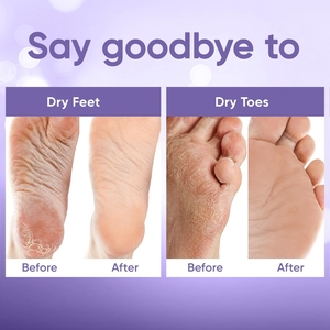 Masque de <span class=keywords><strong>pied</strong></span> exfoliant à la lavande efficace de marque privée élimine les callosités Masque de traitement des pieds apaisant exfoliant doux pour hommes femmes - Product Image 5