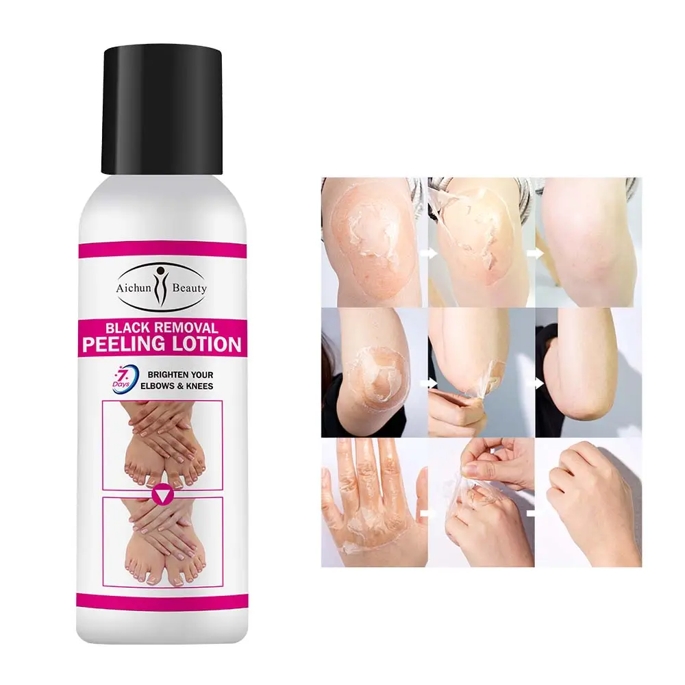 Aichun vẻ đẹp 7 ngày làm sáng khuỷu tay đầu gối loại bỏ màu đen làm trắng lột Lotion