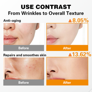 R Private logo Deep Exo Collagen Regenerating Mist Serum Reafirmante y Antienvejecimiento Stem Cell Regeneration Repair Serum Korean Skincare - Product Image 4