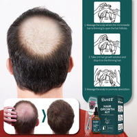 Marque privée Derma Roller Kit d'huile de croissance des cheveux Stimuler le cuir chevelu Repousse des cheveux Sérum essentiel Pour Hommes Femmes Saw Palmetto