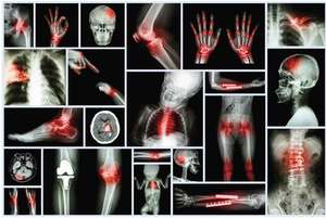 Mini tasarım tıbbi ekipman aksesuarında göğüs ve bacaklarda görüntüleme için radyografi için hepsi bir arada taşınabilir <span class=keywords><strong>x</strong></span>-<span class=keywords><strong>ray</strong></span> makinesi - Product Image 6