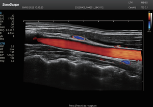 Sonosbape P12 elite ecografo doppler, sistem diagnostik <span class=keywords><strong>ultrasound</strong></span> digital dengan panduan transduser biopsi, peralatan rumah sakit - Product Image 5