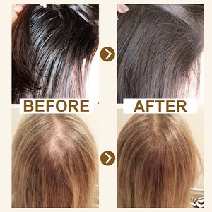 Aceite Esencial para el Cuidado del Cabello OEM, Fortalece el Cabello, Minimiza la Rotura, Estimula los Folículos, Suaviza y Nutre el Cabello Seco - Product Image 3