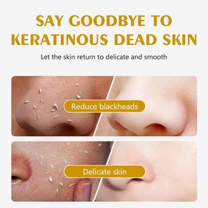 Gel Exfoliante de Limón con Gas de 100 ml para el Cuidado Facial y Corporal, Limpieza Profunda, con Glicerina como Ingrediente Principal, Venta de Fábrica - Product Image 2