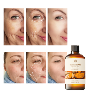 ขายส่งน้ำมันขมิ้นบริสุทธิ์ 100% จากโรงงานโดยตรง เพื่อบำรุง<span class=keywords><strong>ผิว</strong></span>และปลอบประโลมร่างกาย - Product Image 5