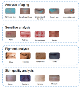 Scanner Digitale 3D AI Certificato per la Pelle del Viso, Macchina Specchio Magico per Estetiste, Analizzatore di Capelli e Pelle per Uso in Cliniche di Bellezza - Product Image 5